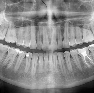 Dentysta Wrocław – Radiologia
