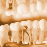 Endodoncja