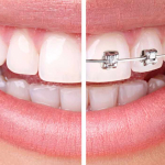 Stomatologia estetyczna